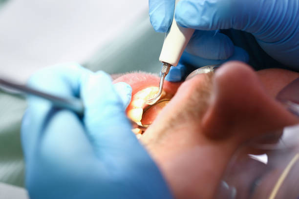 Best Emergency Tooth Extraction in Glenarden, MD