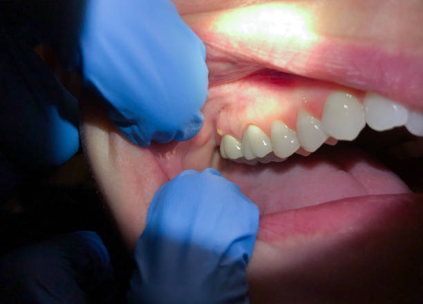Best 24-Hour Emergency Dentist in Glenarden, MD