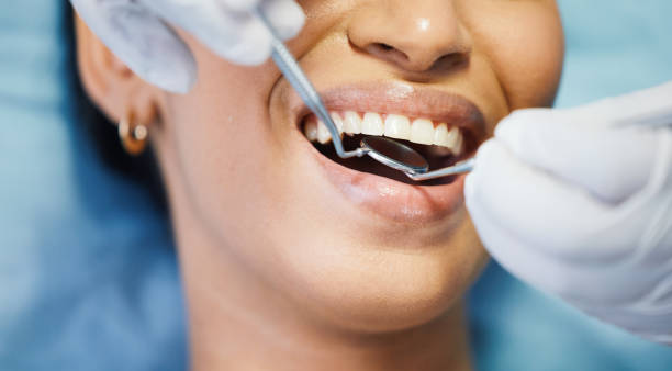 Best Emergency Root Canal Treatment in Glenarden, MD